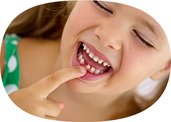 kids-treatment-missing-teeth