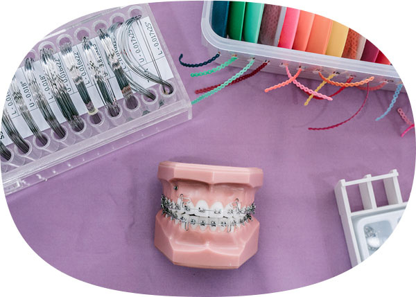 orthodontics-img