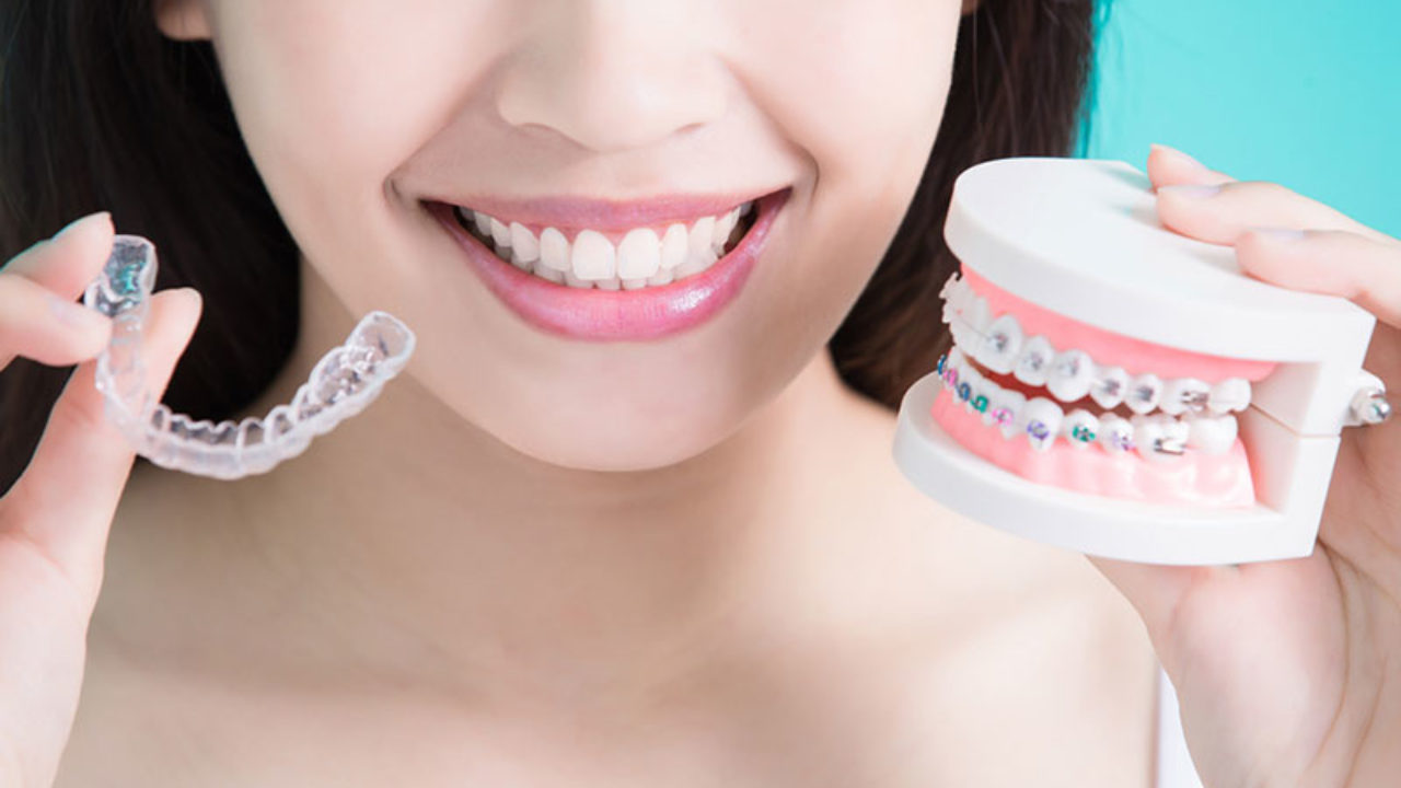 The Different Types of Braces and How to Choose the Right Kind for You
