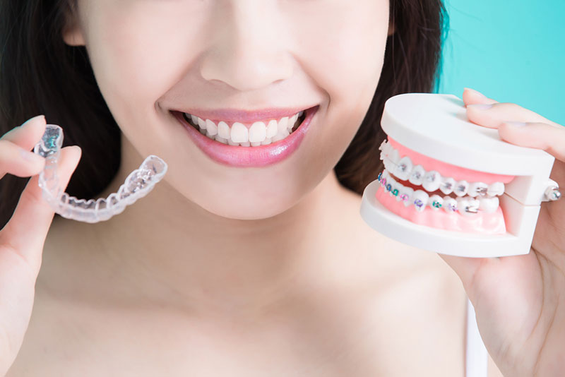 Types of Braces