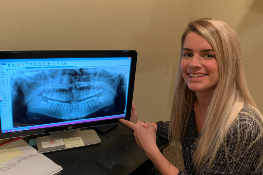 dental-xrays