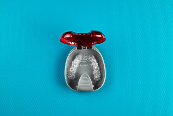 The Dos and Don'ts of Cleaning Your Retainer